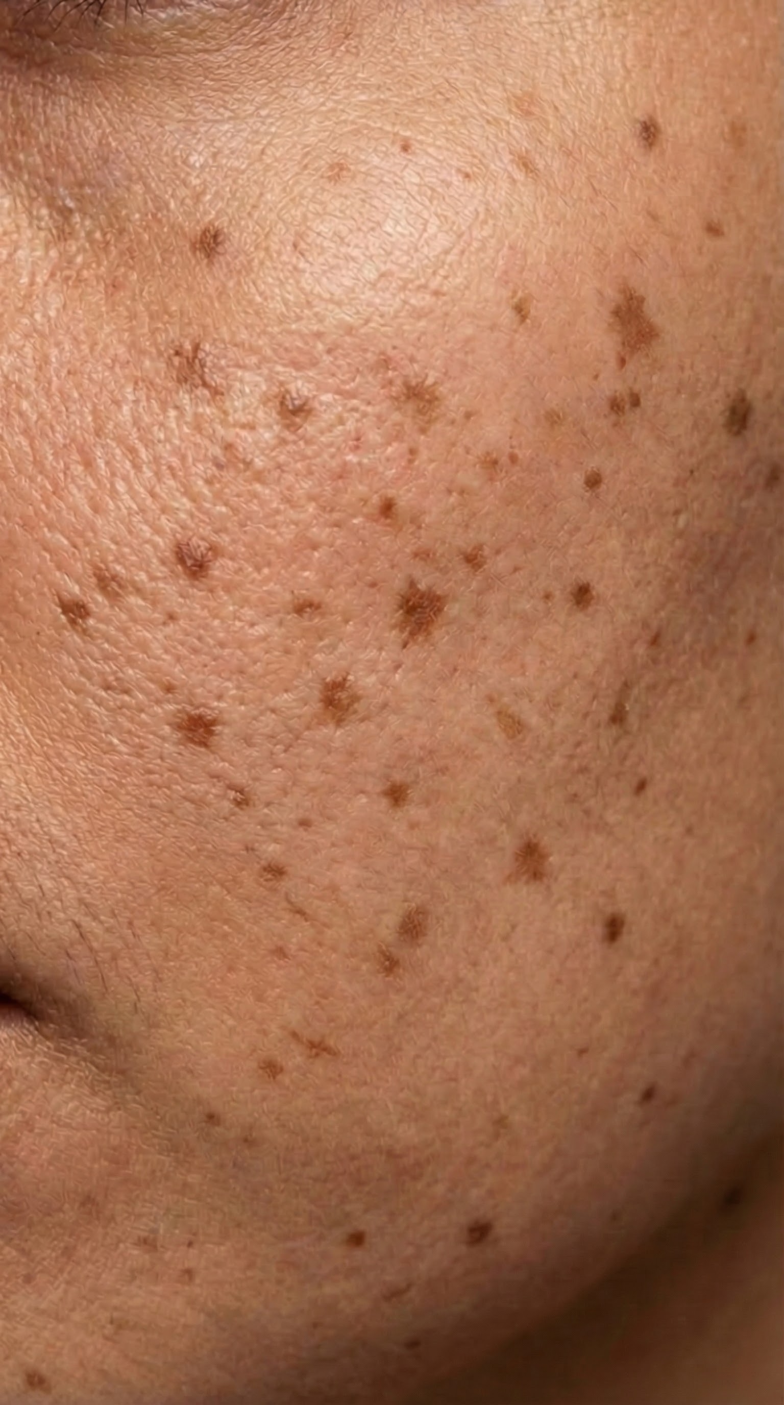 Woche 3 - Erste Effekte